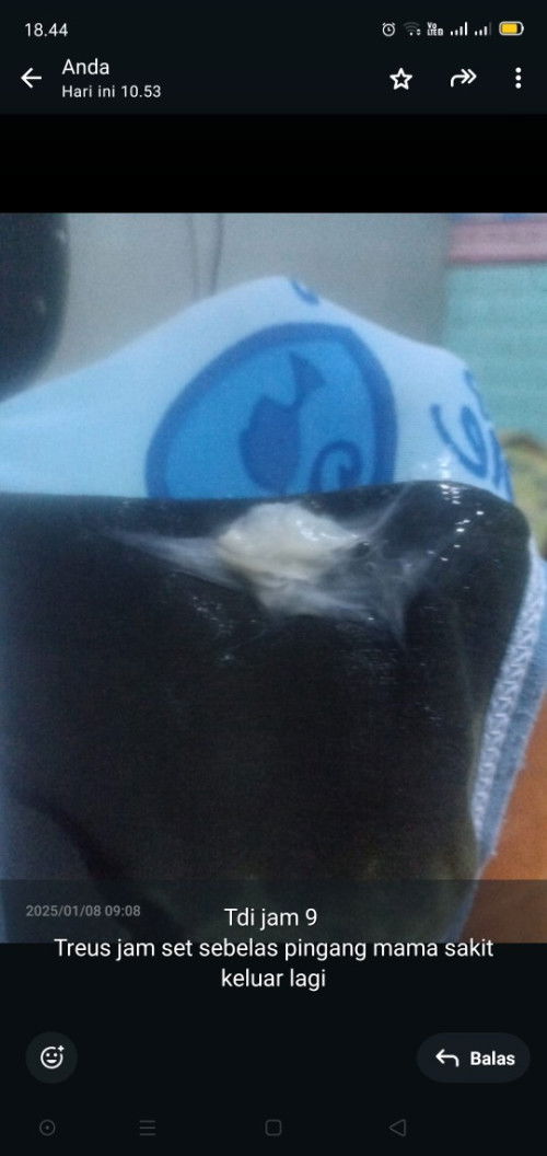 Lendir serviks 38week