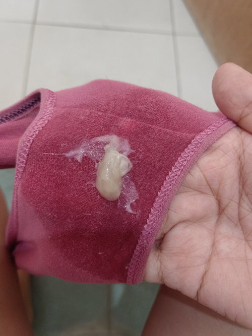 Discharge after 3 months postpartum?