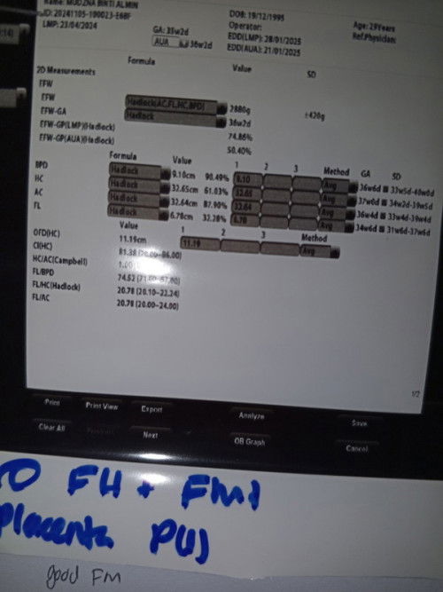 Helo moms" mau tanya terik usg dari klinik tanggal 28/1/2025 Aga" berapa hari lagi nak bersalin yah