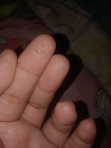 น้ำใสๆซึมที่หัวนม