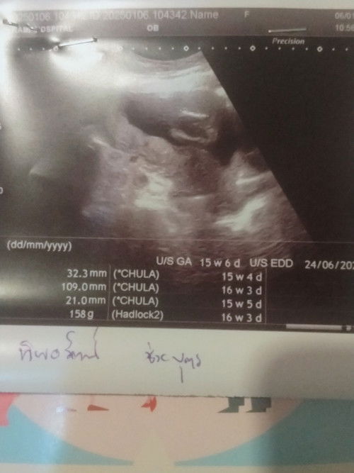 สอบถามหน่อยจ้าตั้งครรภ์15สัปดาป์ละคะทำไมยังไม่เห็นตัวน้องคะ