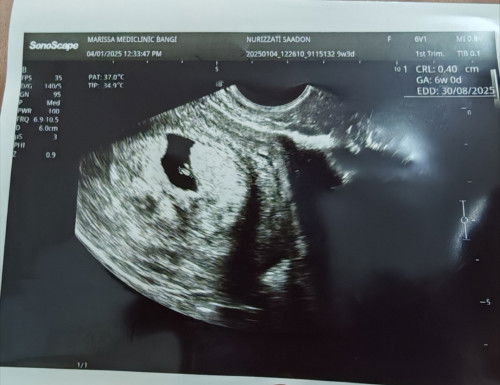 Sy klau ikut LMP 9w tp scan baru 6w