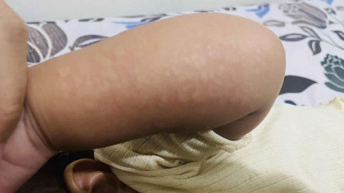 Kulit bayi please respond 🙏