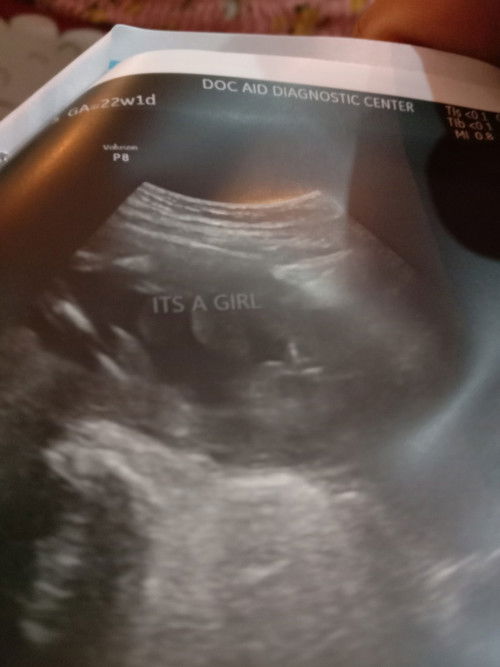 Sure po kayang baby girl siya??