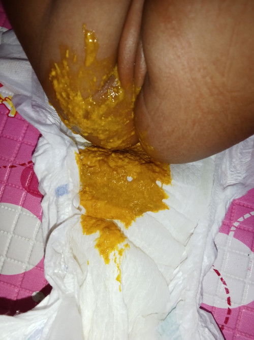 Pup bayi berlendir berbiji