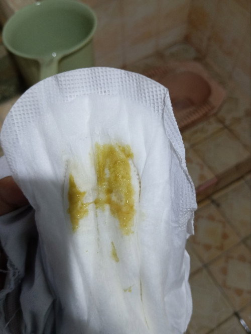 Maaf jorok🙏 kira2 itu kenapa ya bund keluar lendir warnanya kaya gitu aman gak ya?