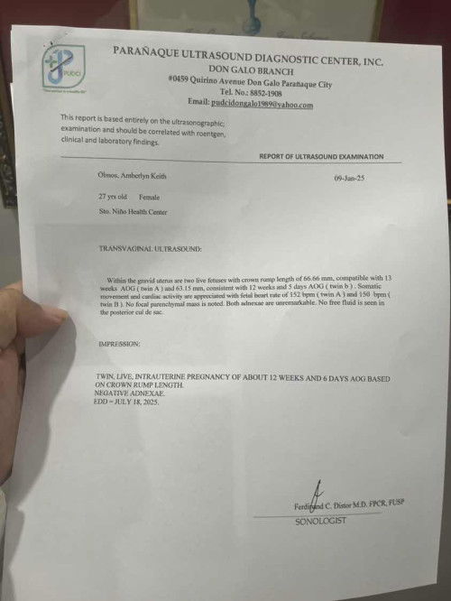 Twins…………….