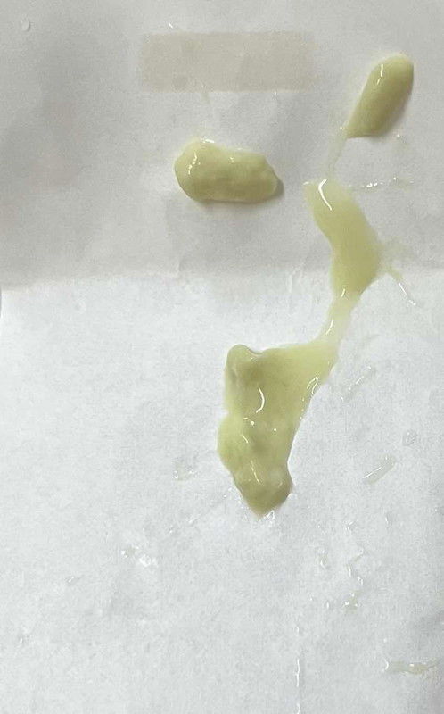 Keputihan hijau tak gatal