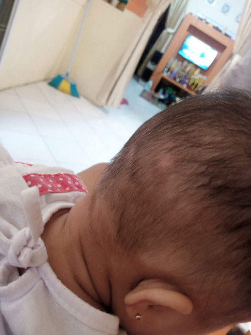 Rambut bayi tidak rata