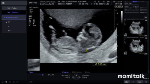 MasyaAllah Tabararakallah udah 11 week