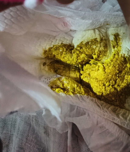 POOP BABY KUNING CAMPUR HIJAU