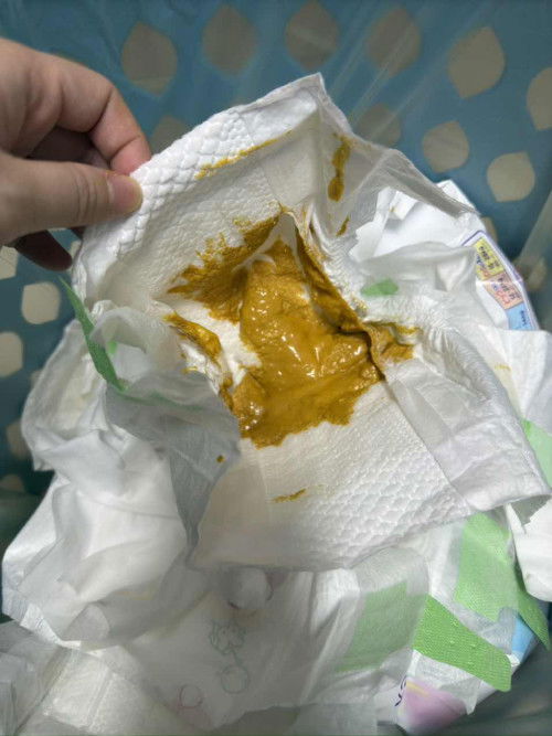 น้องถ่ายเป็นแบบนี้ ใช่ท้องเสียมั้ยคะ