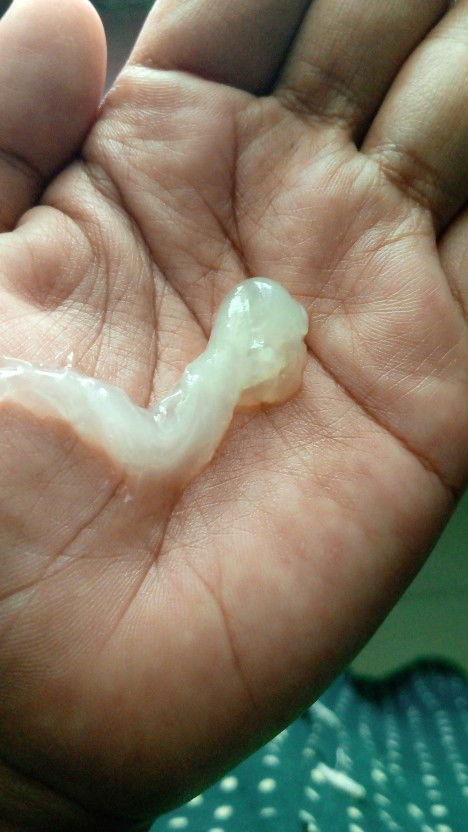 Bun mau nanya aku tadi keluar lendiran kaya yang saya potoin maf yah aga jorok apa itu tanda mau lah