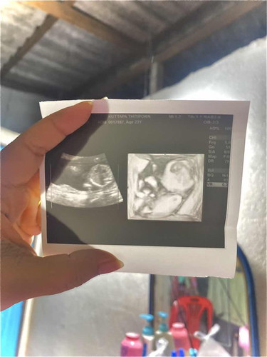 นน ขึ้นเกินไปไหมมม