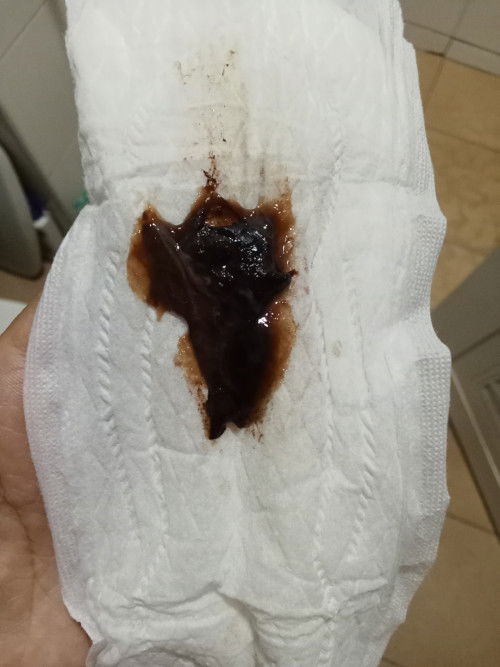 มูกเลือด แต่ไม่ปวดท้อง