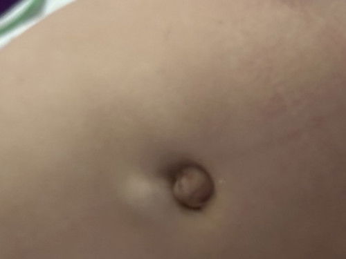 Di atas pusar ada benjol