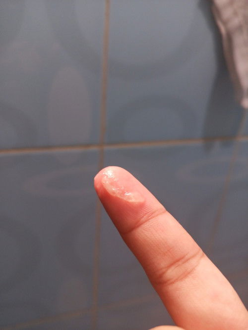 Mucus plug po ba 'to? Kahapon pa po kasi may lumalabas sakin, pero konti konti lang po, 39wks&4days