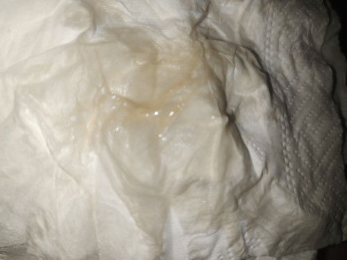 Keputihan atau spotting