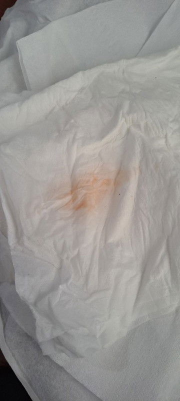 Flek di usia kehamilan 6 minggu