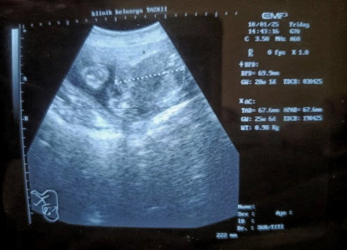 Apakah bisa bantu membaca hasil di foto ini??