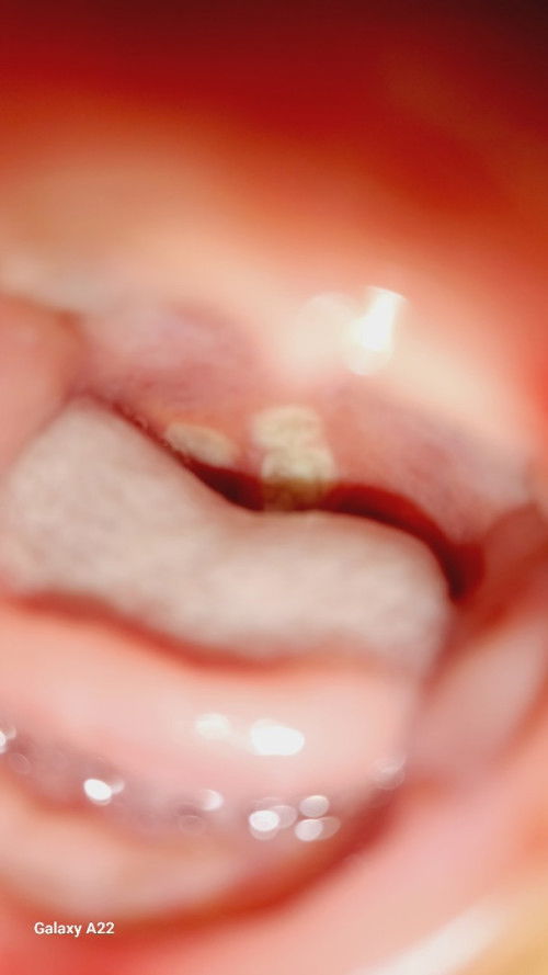 Anak saya jamuren bun,