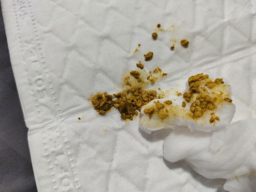 อึเป็นแบบนี้