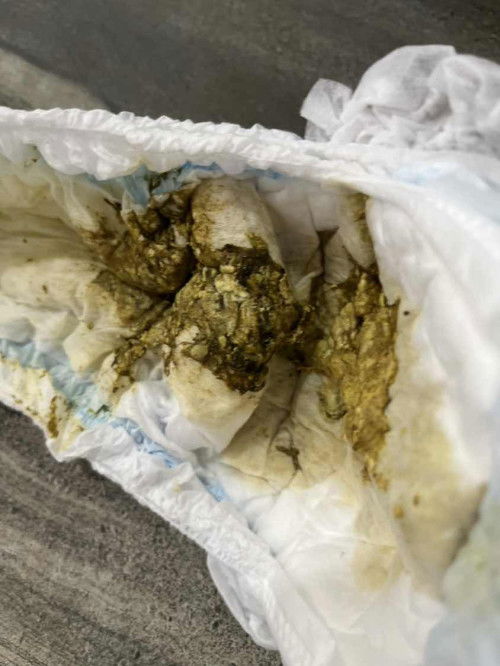 น้องอึแบบนี้ปกติมั้ยค่ะ