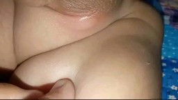 Ruam atw jamur kulit