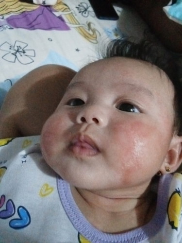Red sa mukha