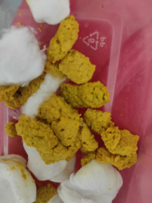 2 months and 4days baby
formula feed

baka merong pedia doctor dito or naipa check up ang baby nila