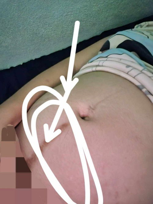 เจ็บตรงที่วงเหนือจิมิอันตรายไหมคะ