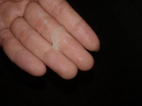 32+5สัปดาห์ มีมูกแบบนี้ออกมาคือปกติมั้ยคะ