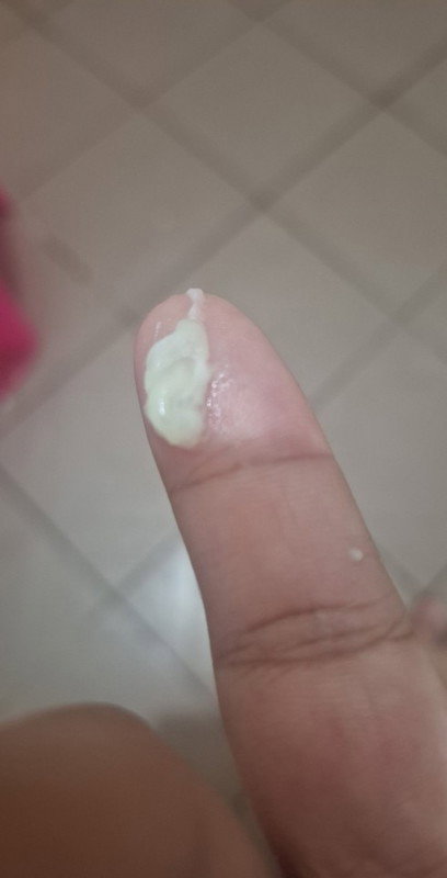 แบบนี้เขาเรียกว่าอะไรข่า เหนียวๆก้อนๆ สีขุ่นๆ
