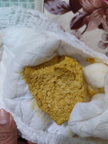 Bayi usia 2 bulan pup seperti ini wajar nggak bun?Sehari pup 1-2x sufor sgm mix asi tpi banyak sufor