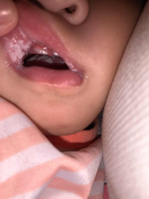 Hello ano po kaya ito?  Mag 11 months na po sya ngayong January