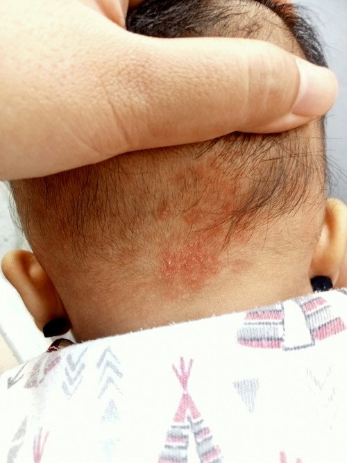 Kenapa ya bun kira²