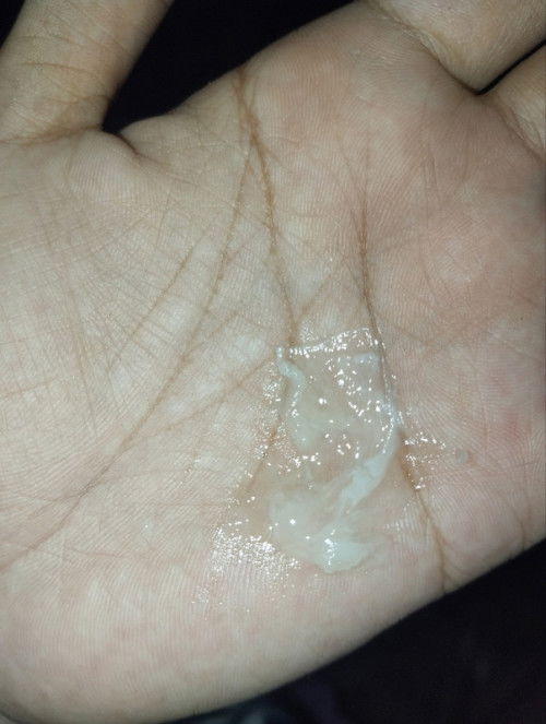 Lendir di usia 38 w 1 d