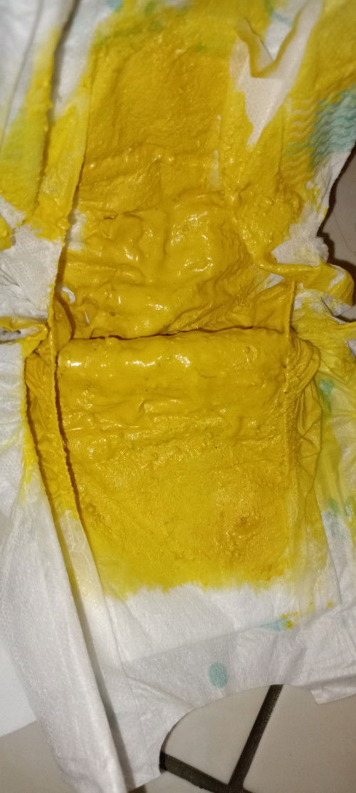 Wajar nggk sih moms warna pup nya