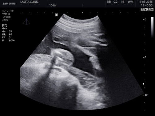 ช่วยดูหน่อยค่ะ