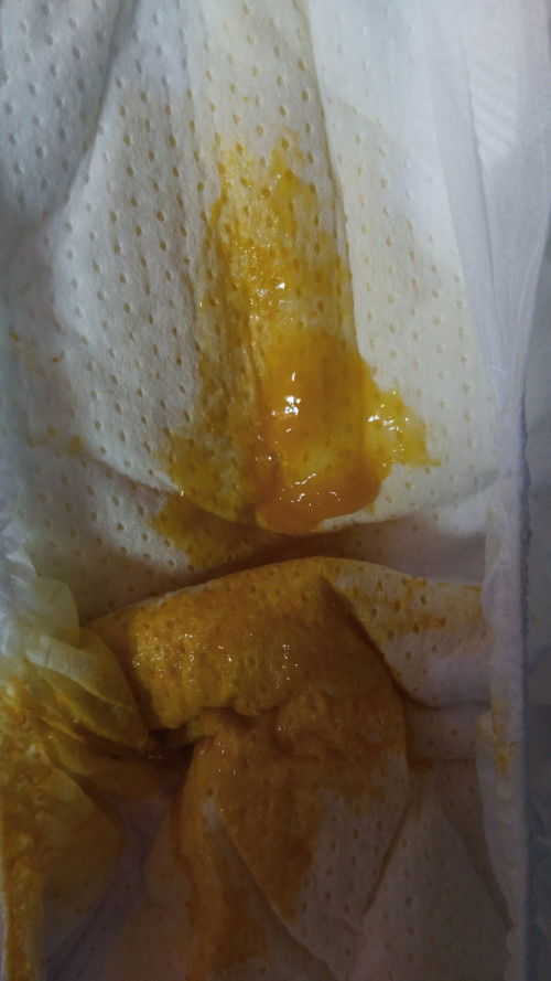 น้อง4เดือน