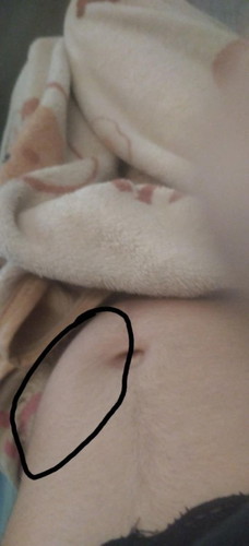 ท้องแข็งบ่อยๆ