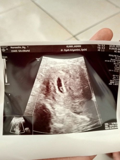 Pengalaman Pejuang Garis 2 Penantian 7tahun ✨🩷