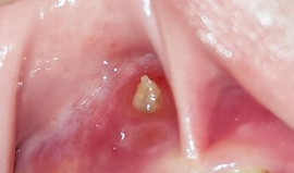 Pedia Dentist