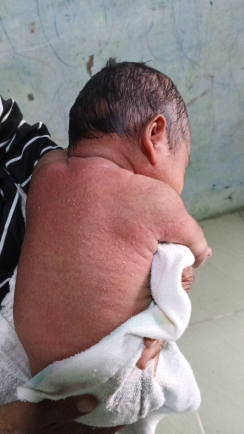 Kulit bayi merah