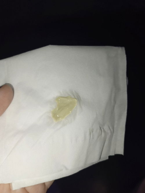 mendekati hpl 38 week