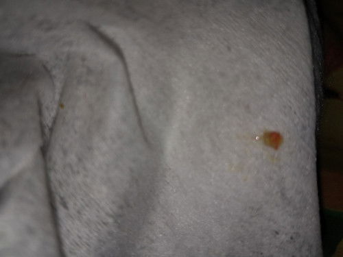 Tanya tentang pupu bayi