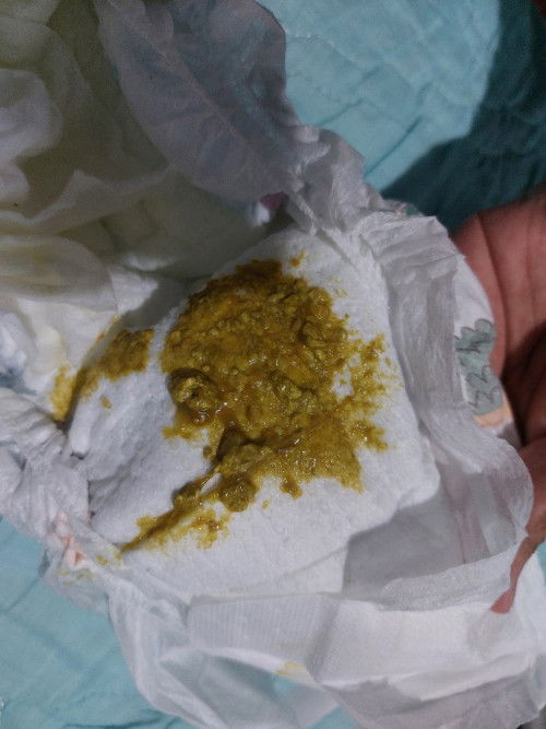 Poops ni baby 4 months old. Mix feed.