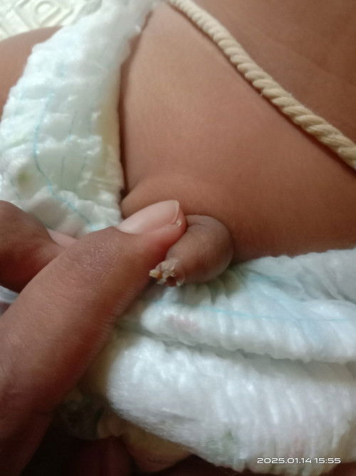 dalam kulup bayi ada putih2 aman tidak?