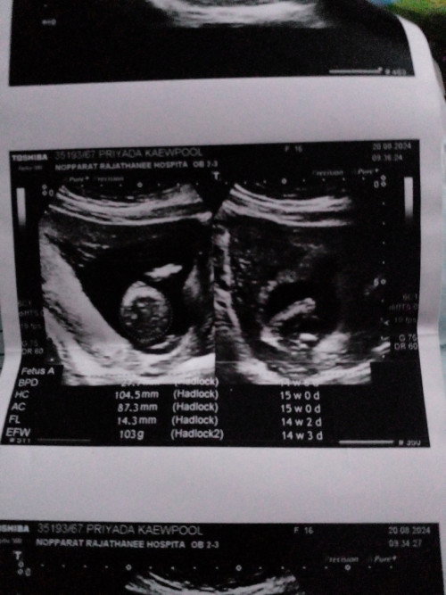 อันนี้สามารถรู้เพศได้ไหมค่ะ