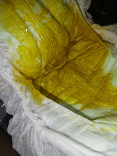 pup seperti ini normal gak ya?